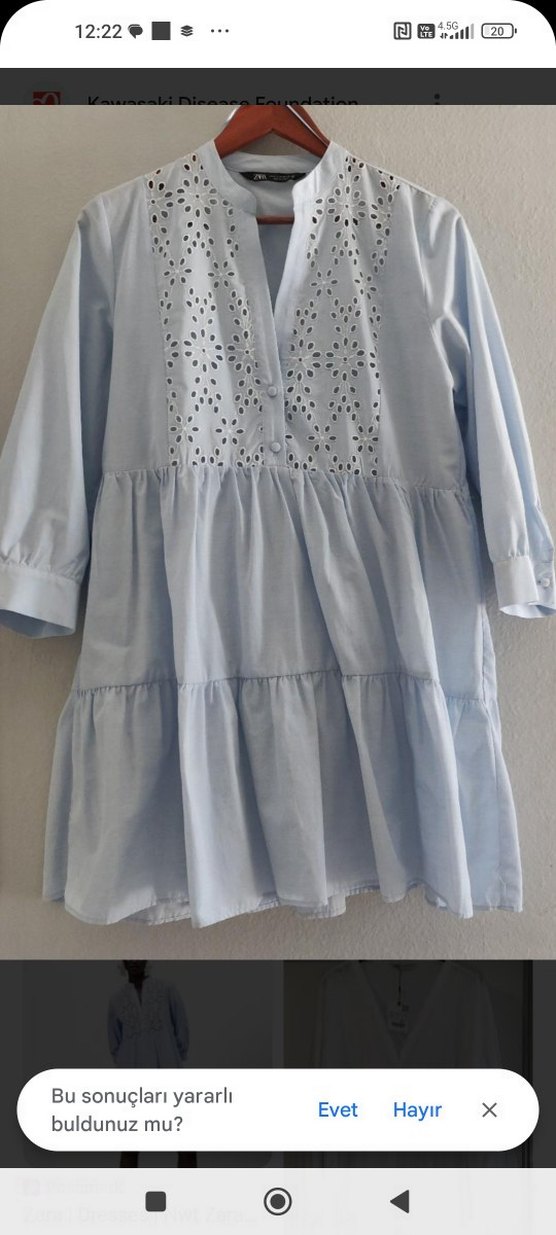 Nakışlı V Yakalı Mavi Elbise - Görsel 2