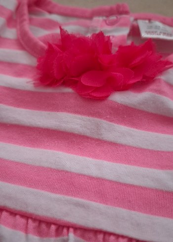 Kız Çocuk Pembe Çizgili Kolsuz Elbise - Görsel 3