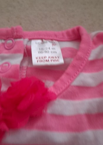 Kız Çocuk Pembe Çizgili Kolsuz Elbise - Görsel 2