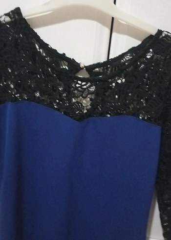 Dantel detaylı mavi elbise - Görsel 2