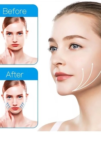 Çene Şekillendirici - Görsel 3