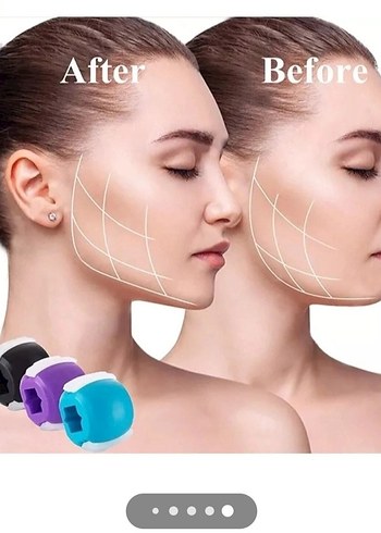 Çene Şekillendirici - Görsel 2