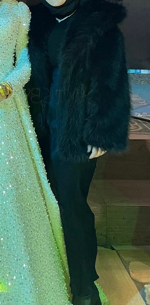 Kürk Detaylı Siyah Midi Kapüşonlu Mont - Görsel 2