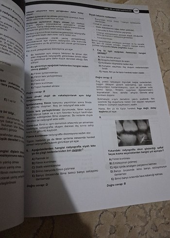 DUS Akademi Ağız Diş Çene Radyolojisi Soruları 3. Baskı - Görsel 5