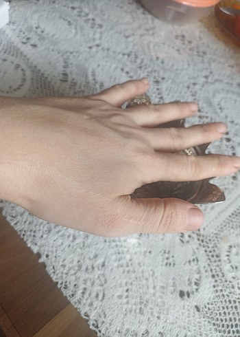 Şekerlik - Görsel 6