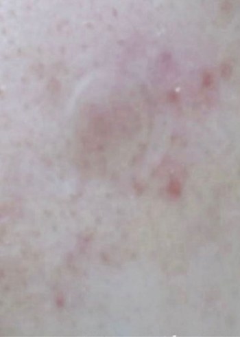 Withederm Skincare Ürünleri - 105 Adet - Görsel 4