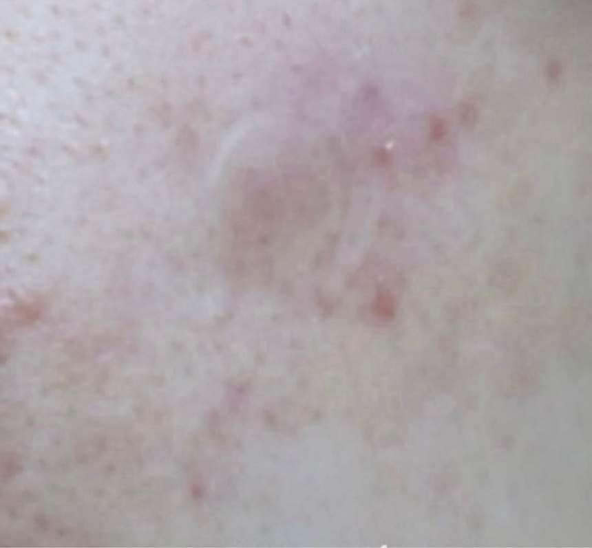 Withederm Skincare Ürünleri - 105 Adet - Görsel 4