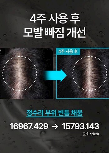 NR Siyah Fasulye Dokulme Ampul-50mL - Görsel 5