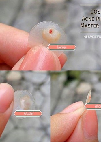 Cosrx Acne Pimple Master Patch - Görsel 3