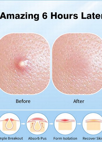 Cosrx Acne Pimple Master Patch - Görsel 11