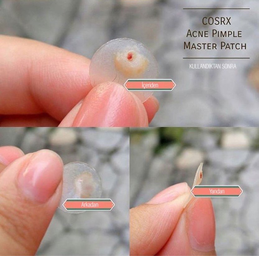 Cosrx Acne Pimple Master Patch - Görsel 3