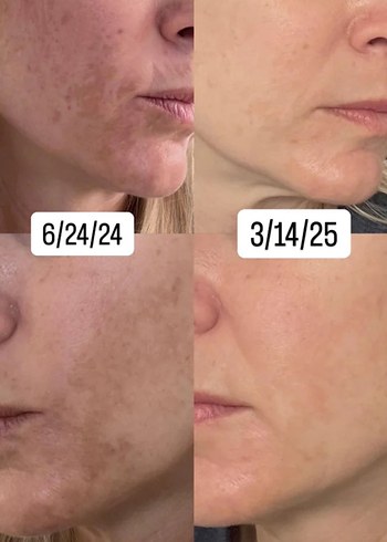 Domina Koyu Ton BB Krem 50g - Görsel 7