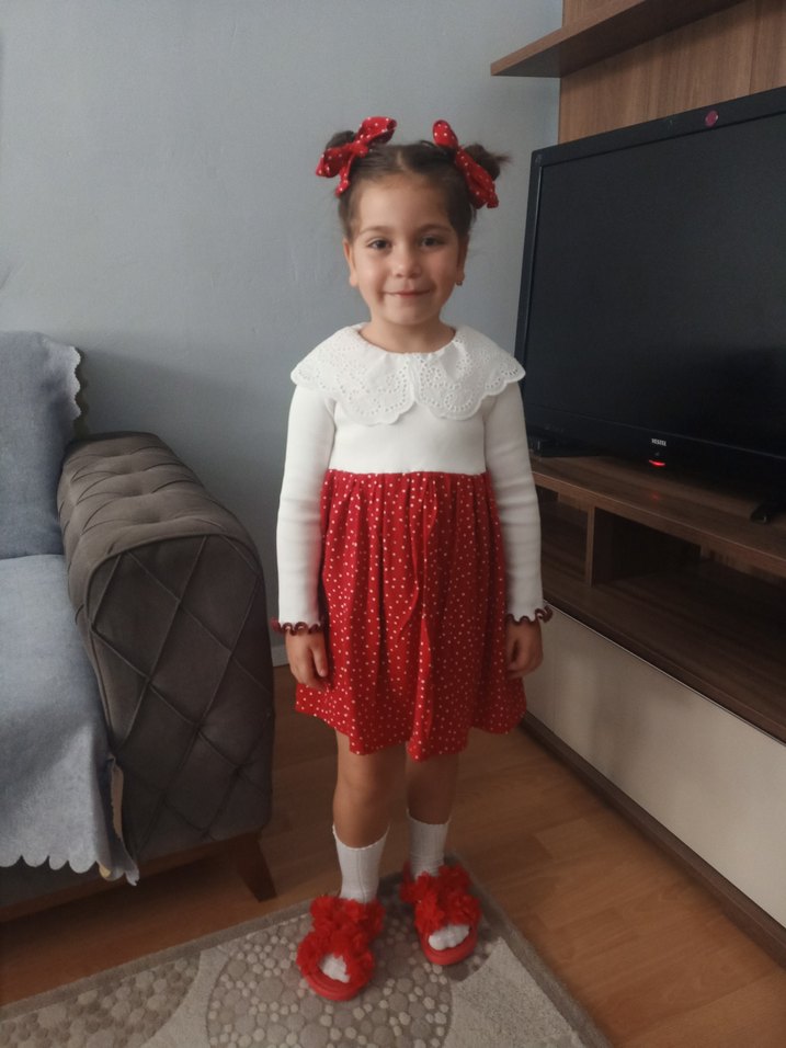 Kız Çocuk Kırmızı Puantiyeli Triko Elbise - Görsel 2