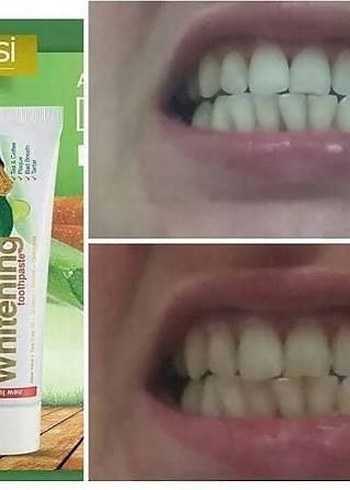 Diş Beyazlatıcı Macun