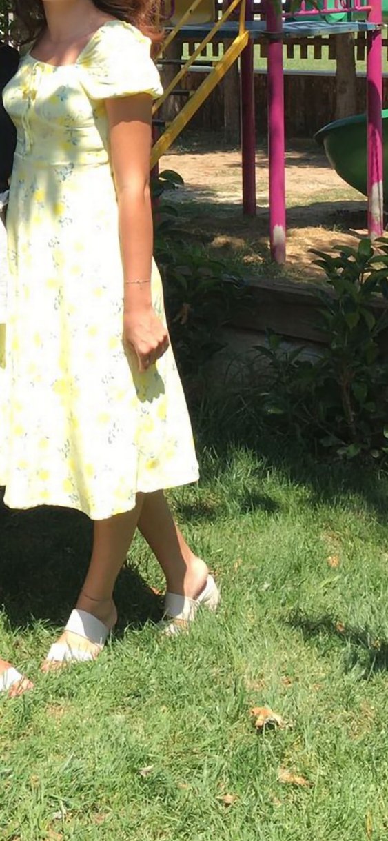 Sarı Pamuklu Çiçek Desenli Midi Etek - Görsel 3