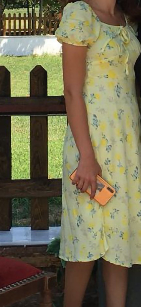 Sarı Pamuklu Çiçek Desenli Midi Etek - Görsel 2