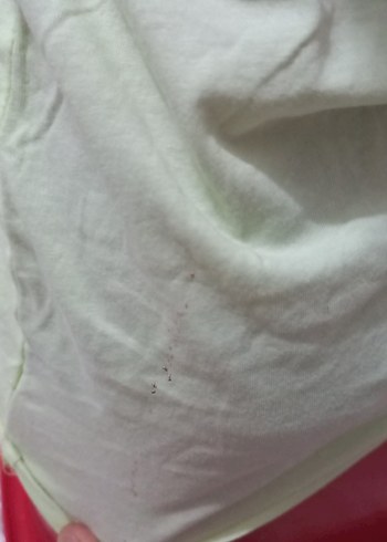 Düğmeli Mini Yeşil Kadın Atlet - Görsel 3