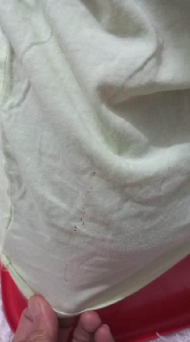 Düğmeli Mini Yeşil Kadın Atlet - Görsel 3