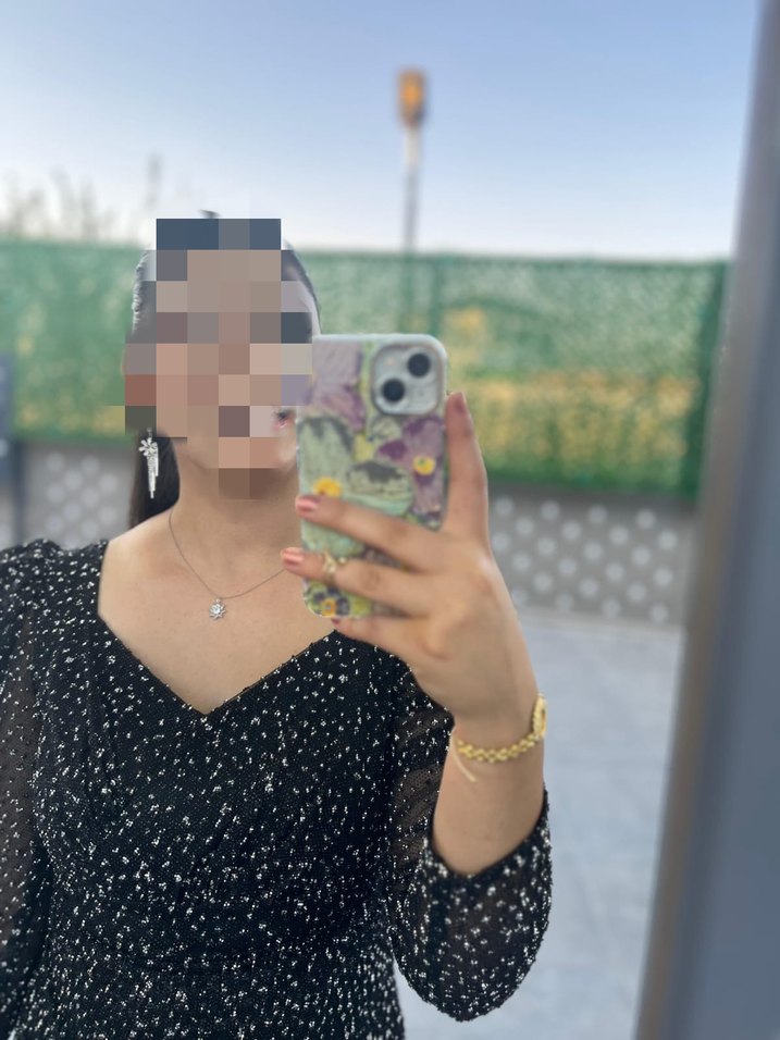 Şeffaf Uzun Kollu Yılan Desenli Siyah Elbise - Görsel 3