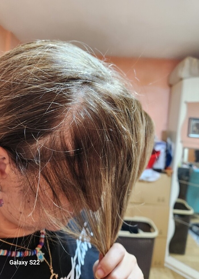 Tarakli peruk - Görsel 4