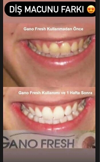Diğer Gano freş diş macunu