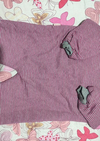 Fermuarlı Zebra Desenli Bebek Tulumu - Görsel 5