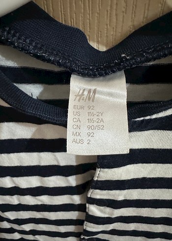 Düğmeli Çizgili Erkek Bebek Tulum - Görsel 2