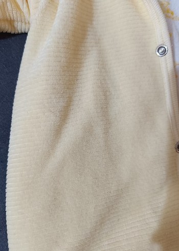 Sarı Kapüşonlu Bebek Kış Tulumu - Görsel 5