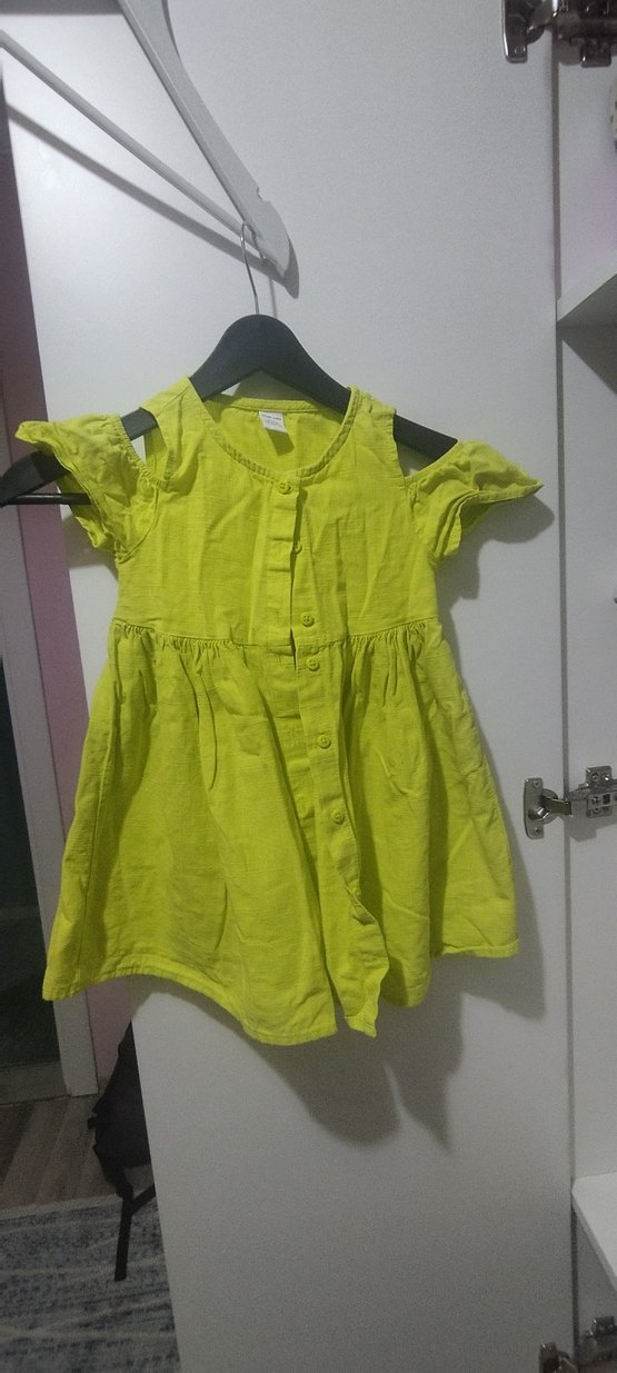 Sarı Düğmeli Elbise - Görsel 3