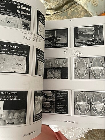 Protez 2. Sınıf Ders Notları - Görsel 2