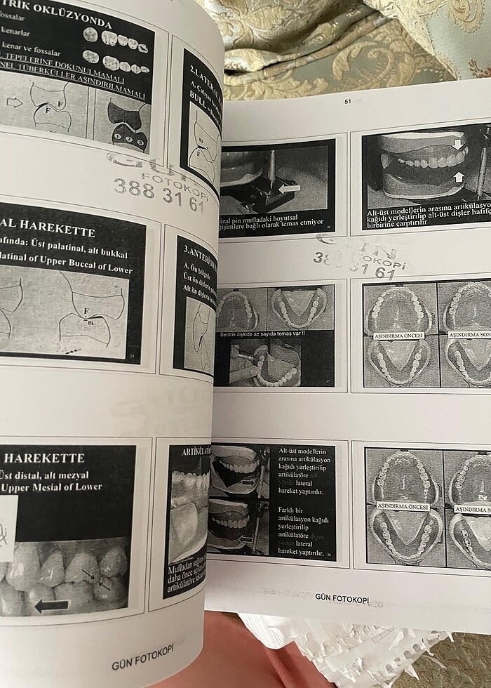Protez 2. Sınıf Ders Notları - Görsel 2