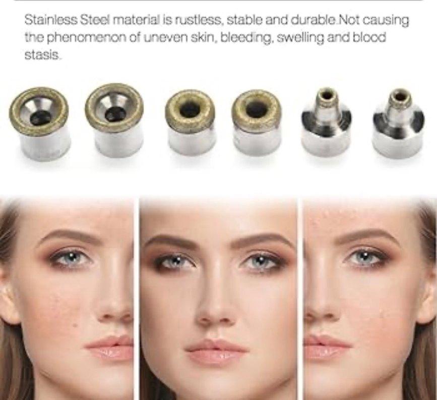 ELMAS PEELİNG UÇLARI / MİKRODERMABRAZYON - Görsel 3