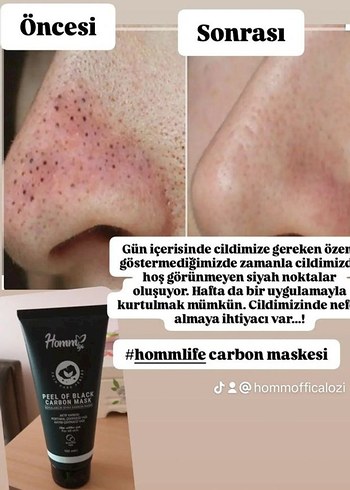 Siyah Karbon Peeling Maskesi - Görsel 3