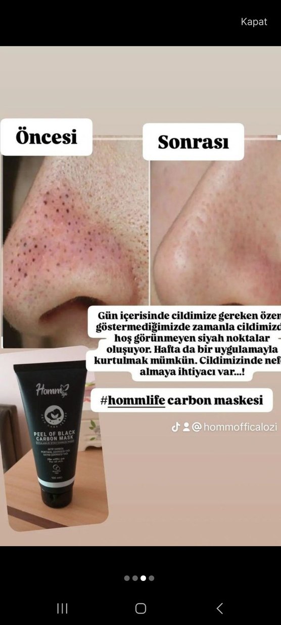 Siyah Karbon Peeling Maskesi - Görsel 3