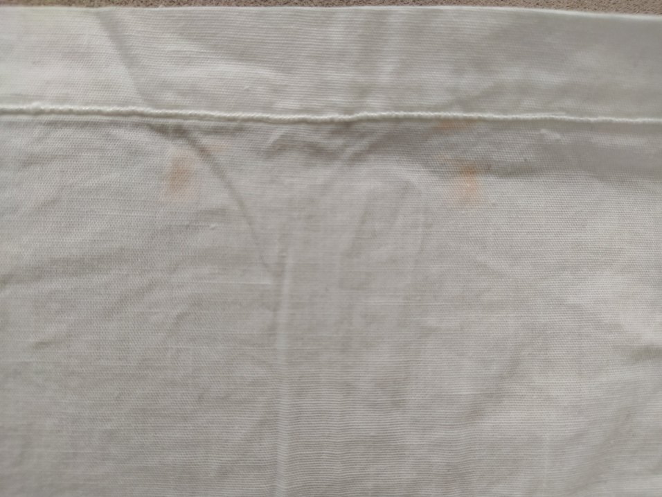 DELİK İSİ KAEYOLA ETEĞİ - Görsel 5