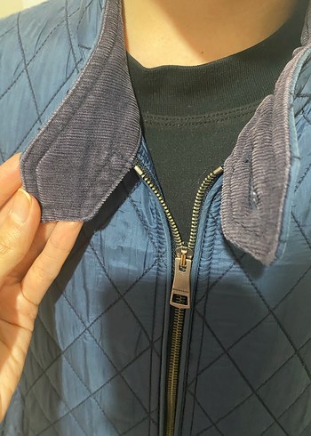 Mavi Burberry Ceket - Görsel 11