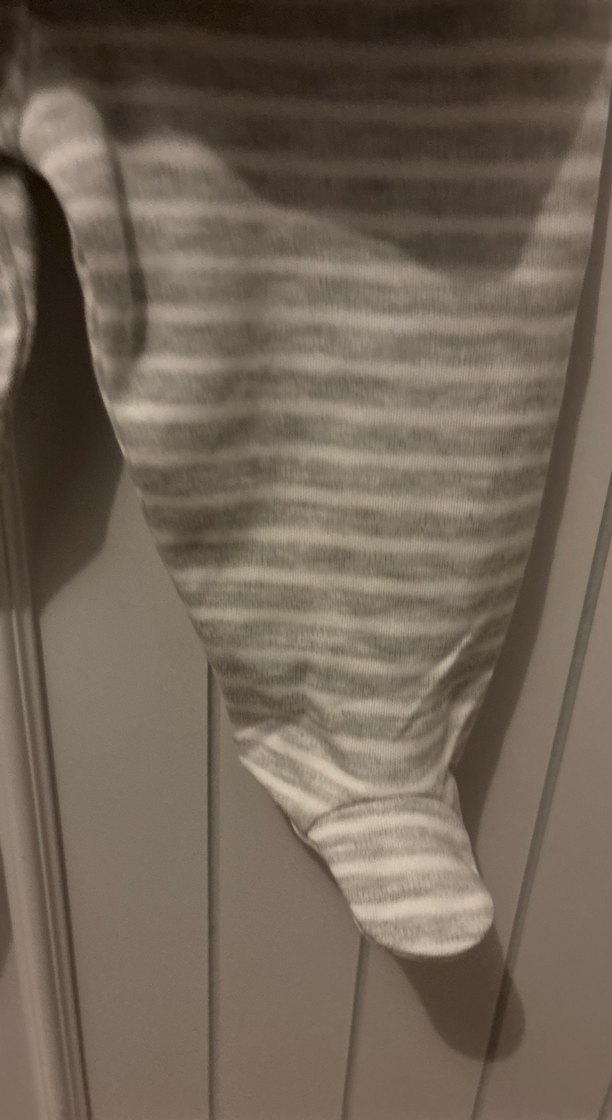 Gri Uzun Kollu Bebek hastane çıkışı - Görsel 4