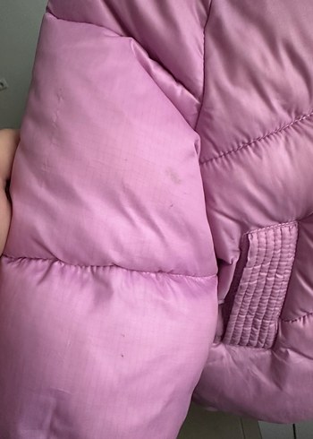 Düğmeli Pembe Kız Çocuk Mont - Görsel 3