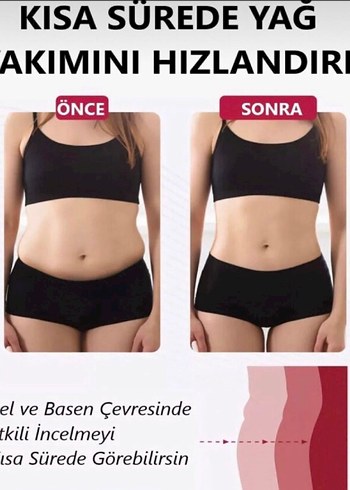 Beyaz Mini Hemşire Korsesi, Fit Kesim - Görsel 2