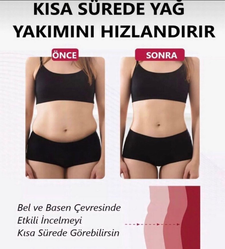 Beyaz Mini Hemşire Korsesi, Fit Kesim - Görsel 2