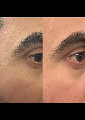 XAURA KIRIŞIKLIK SERUMU 24K ALTIN - Görsel 2