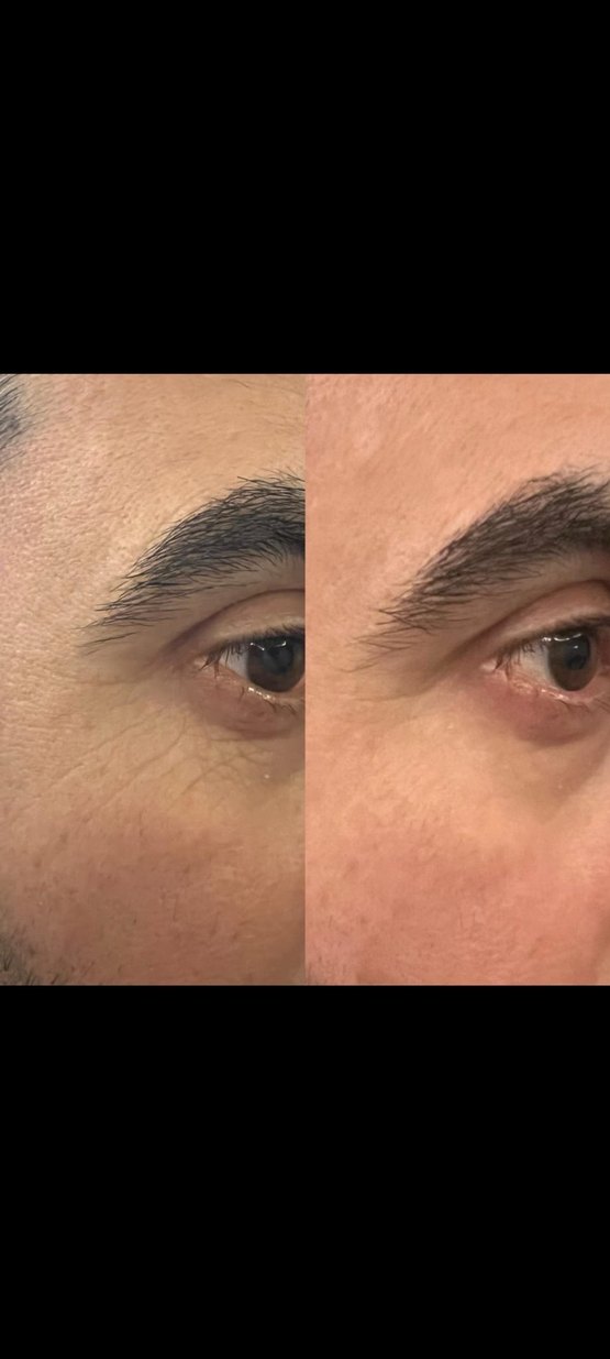 XAURA KIRIŞIKLIK SERUMU 24K ALTIN - Görsel 2