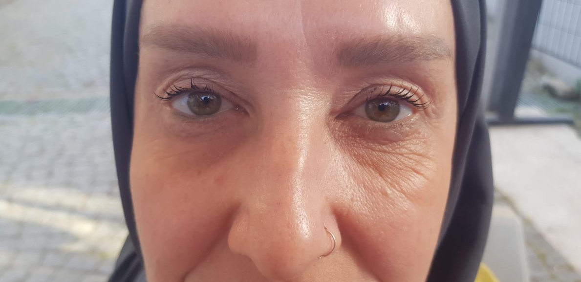 XAURA KIRIŞIKLIK SERUMU 24K ALTIN - Görsel 3