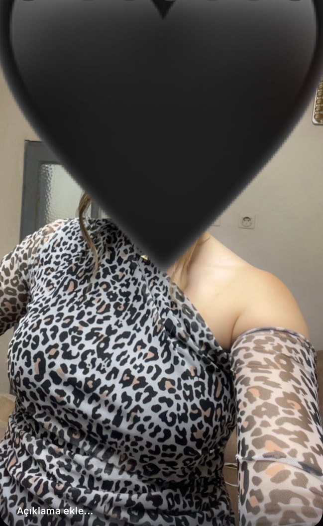 Gri Yılan Desenli Uzun Kollu Mini Elbise - Görsel 2