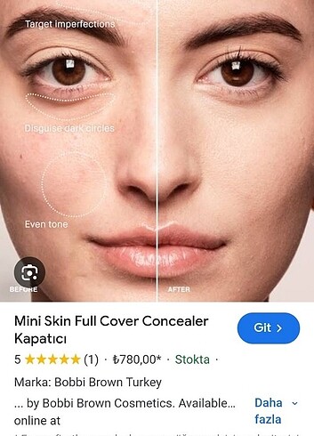  Beden Serum katıldı kapatıcı 