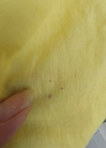 Sarı V Yakalı Nakışlı Bohem pareo - Görsel 8