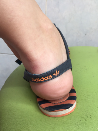 Adidas parmak arası sandalet