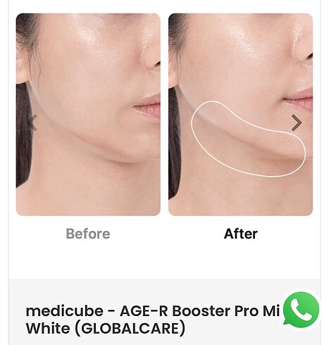 Medicube AGE R booster Pro mini - Görsel 4