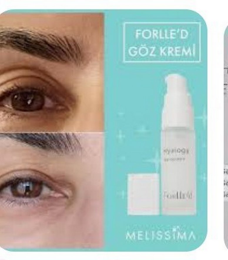 Melissima Göz Kremi - Görsel 2