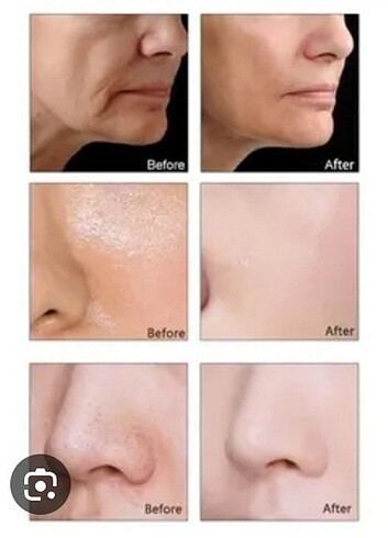 Peeling serum New paradise